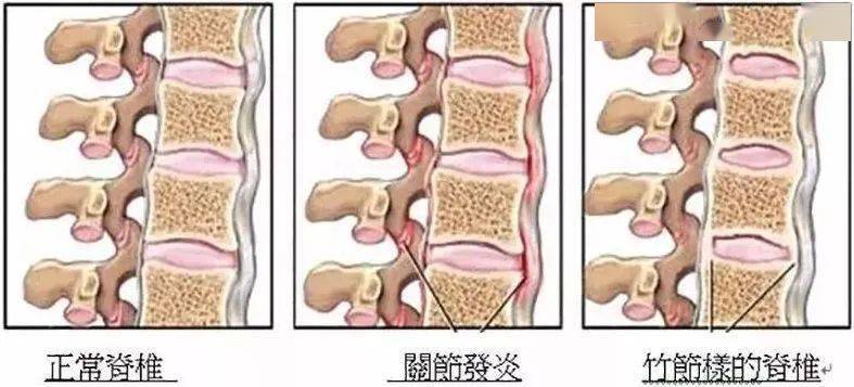 第1521頁